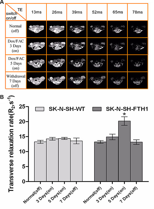 In vivo MRI results of a cell graft with (&#x201C;on&#x201D;) and without (&#x201C;off&#x201D;) induced FTH1 expression.