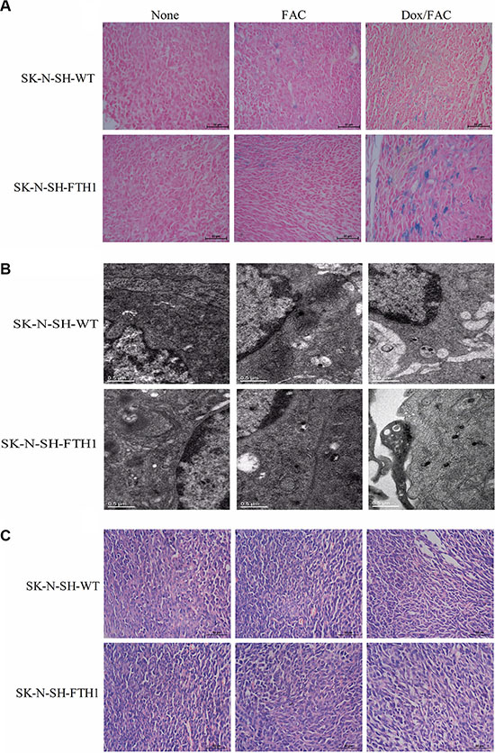 Ex vivo histological validation of FTH1 expression induced in subcutaneous SK-N-SH-WT and SK-N-SH-FTH1 tumors.