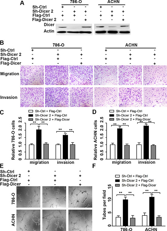 Dicer rescue abrogated Dicer-knockdown-induced ccRCC cell migration, invasion and angiogenesis.
