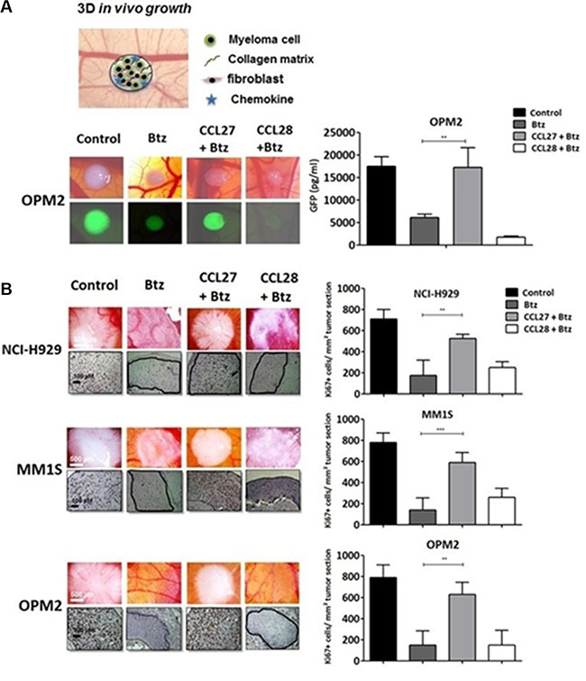CCL27 rescues myeloma cells from bortezomib-induced cell death in a xeno-transplanted model.
