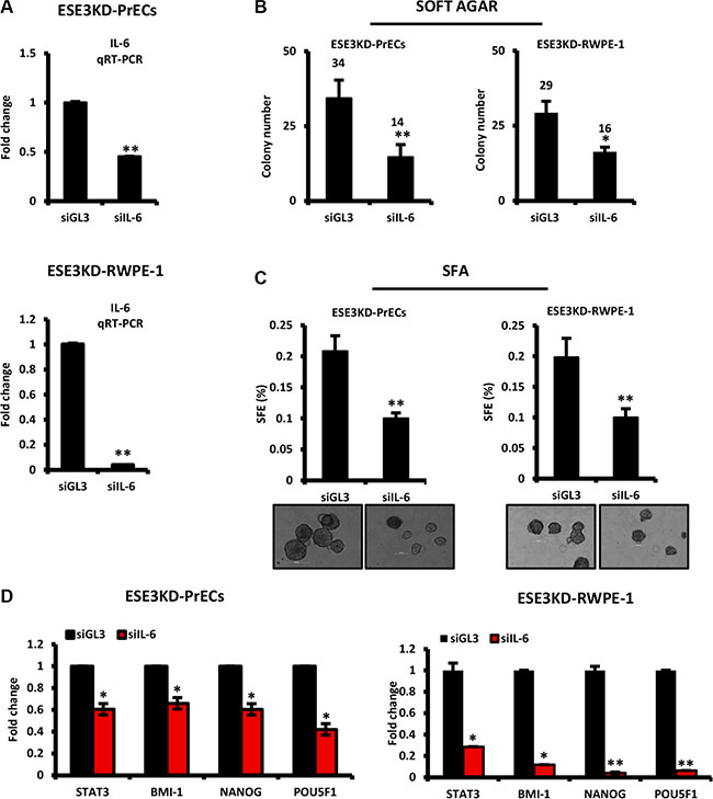 IL-6 is a mediator of prostate epithelial cell transformation and stem cell properties upon loss of ESE3/EHF.