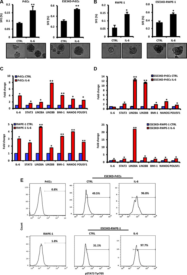 IL-6 induces transformation and cancer stem-like phenotypes in normal and more significantly in ESE3KD prostate epithelial cells.