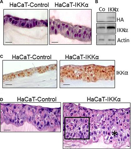 Histological characterization of HaCaT-Control and HaCaT-IKK&#x03B1; skin equivalents.
