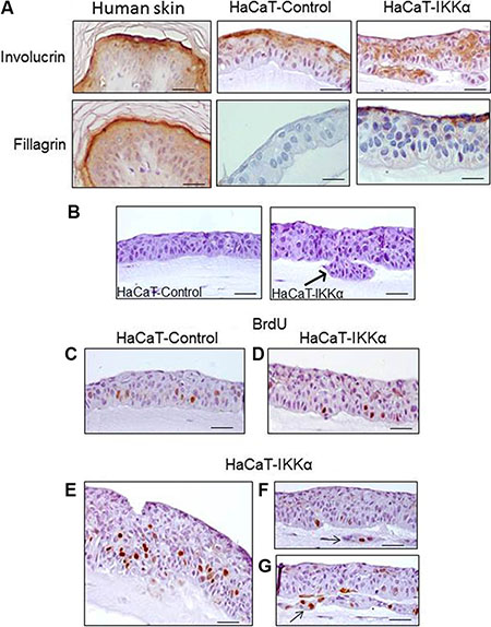 Altered differentiation, increased proliferation and invasion foci in the HaCaT-IKK&#x03B1; skin equivalents.