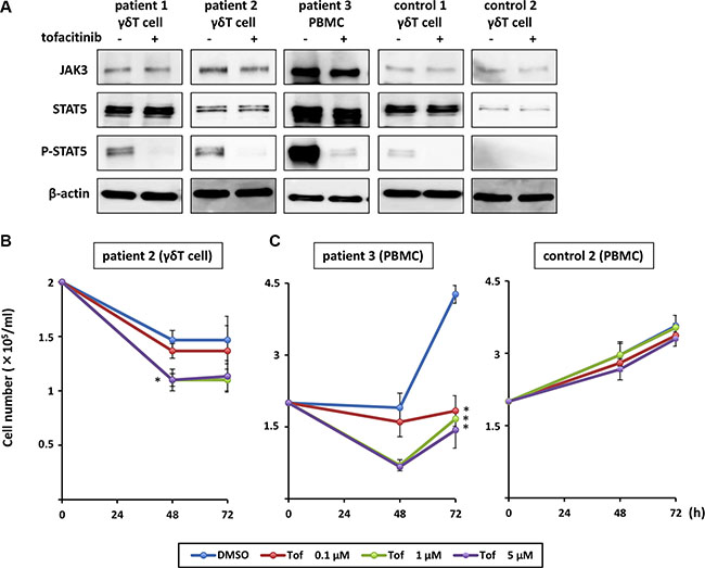 Effects of tofacitinib on JAK3/STAT5 pathway components and growth in EBV-infected cells isolated from patients with EBV-associated T cell lymphoma.