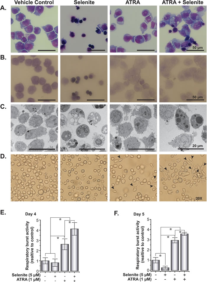 Selenite in combination with ATRA potentiates the maturation of NB4 cells.