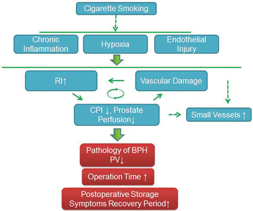 Schematic model of the effects of smoking on prostate vascular and perioperative characteristics.