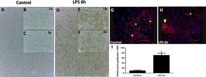 PARP and Caspase staining in placenta from LPS treated group compared to control.