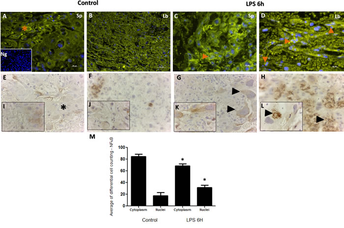 Immunohistochemical localization of NF-&#x3ba;B in placenta from LPS treated and control groups.