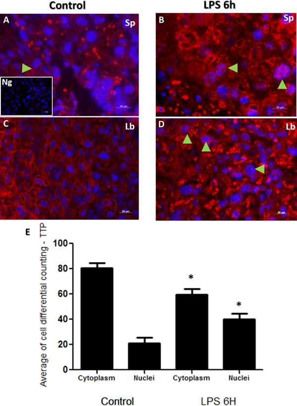 Immunohistochemical localization of TTP in placenta from LPS treated and control groups.