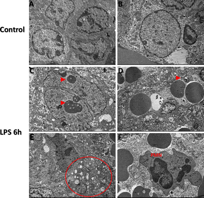 Transmission Electron Microscopy images of TTP expression via in LPS treated and control groups Transmission electron microscopy findings in control (A and B) and LPS (Panels C-F) treated placental trophoblast cells.