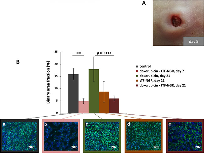 Tumor macroscopic appearance and proliferation as shown by Ki-67 staining.