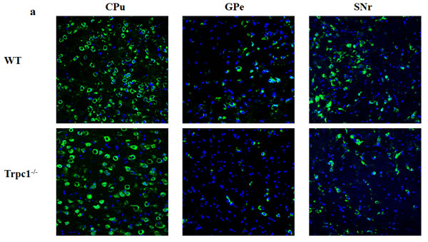 TRPC1 depletion caused neuronal loss in basal ganglia.