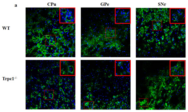 TRPC1 depletion caused the loss of DA neurons in basal ganglia.