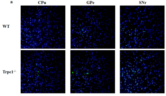 TRPC1 depletion caused neuronal apoptosis in basal ganglia.