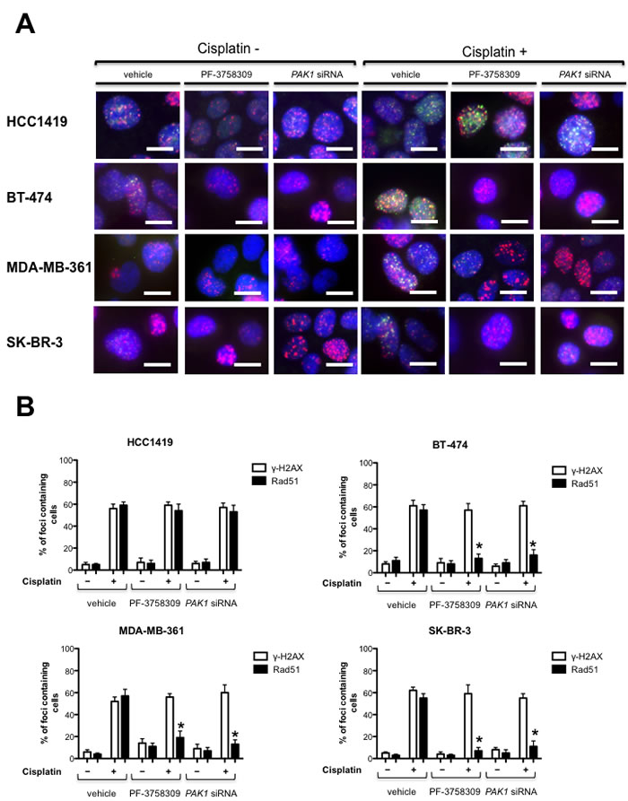 PAK inhibition reduces the formation of Rad51 foci.