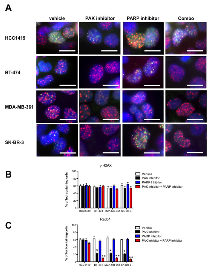 Combined PAK and PARP inhibition impairs DNA repair by Homologous Recombination in PAK overexpressing breast cancer cells.