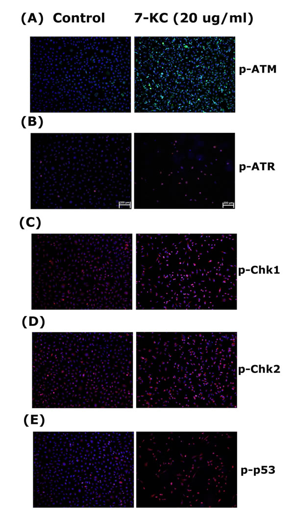 Stimulation of p-ATM, p-ATR, p-Chk1, p-Chk2 and p-p53 expression by 7-KC (20 &micro;g/ml) to endothelial cells.