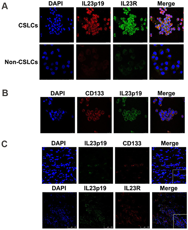 IL-23 and IL-23R expression in ovarian CSLCs.