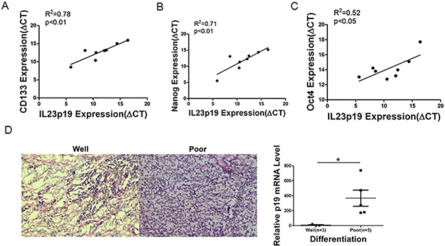 Correlation between IL-23p19 expression and CD133, Nanog, Oct4 levels and degrees of differentiation in primary ovarian cancer tissue.