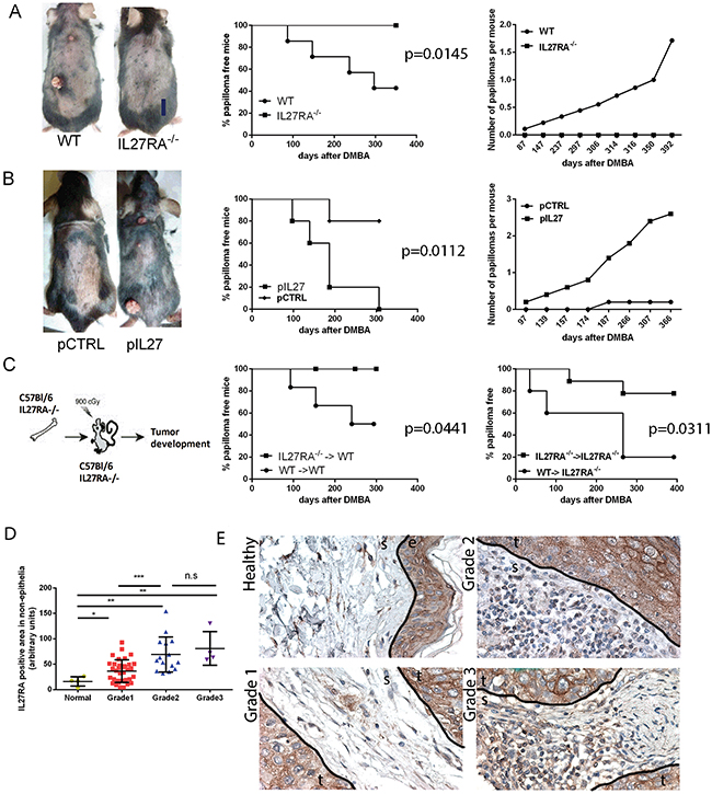 IL27 signaling promotes skin carcinogenesis.