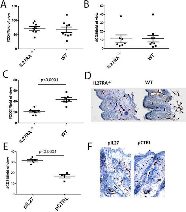 IL27 induces angiogenesis in the pre-malignant skin.