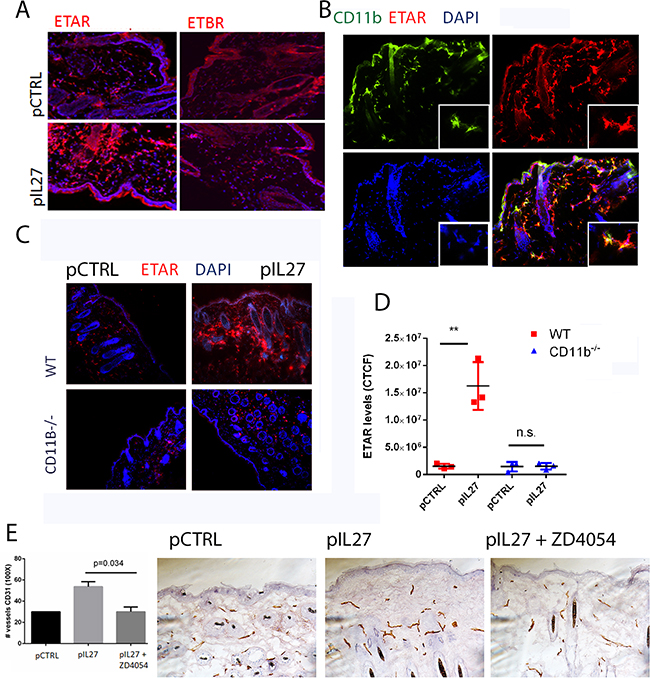 CD11B cells are required for IL27-induced angiogenesis via upregulation of Endothelin Receptor A in the pre-malignant niche.