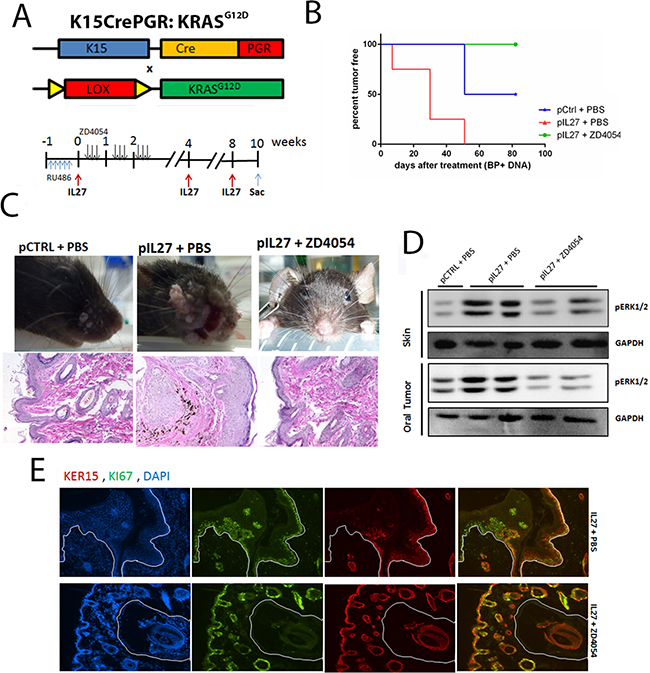 IL27 enhances papilloma formation and proliferation of mutated bulge stem cells via ETAR.