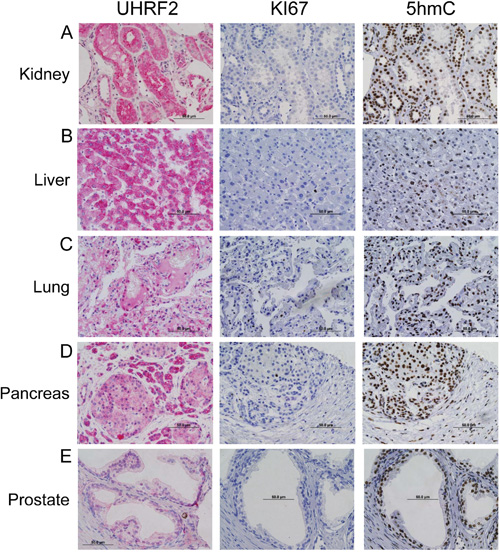 UHRF2 is expressed in differentiating cell populations.