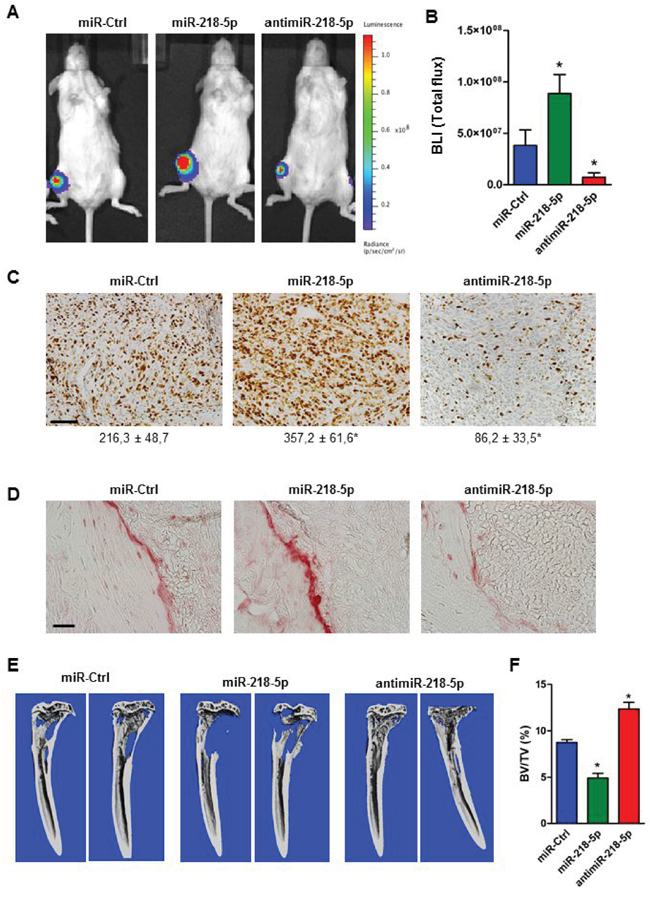 AntimiR-218-5p treatment reduces tumor growth and protects from breast cancer-induced osteolytic disease.