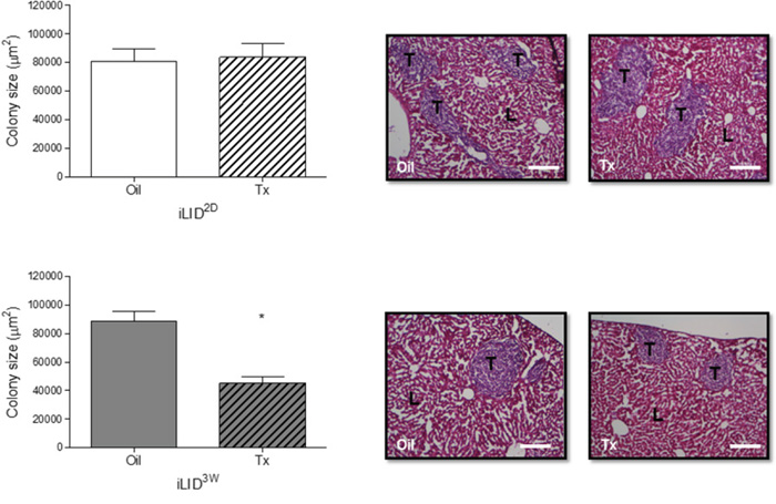 Decreased growth of liver metastases in mice with a sustained IGF-I deficiency.