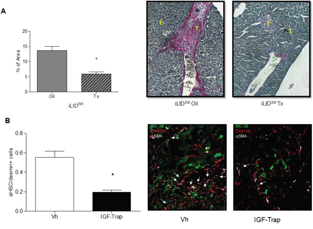 A sustained IGF-I deficiency reduces collagen production in tumor-injected mice and treatment with an IGF-I inhibitor impairs HSC activation.