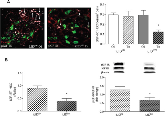 Decreased IGF-IR levels and reduced IGF-IR activation in hepatic stellate cells obtained from mice with a sustained IGF-I deficiency.