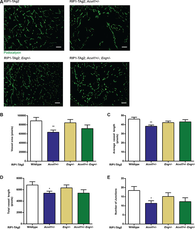 Deficiency of Acvrl1 alone reduces tumor angiogenesis.