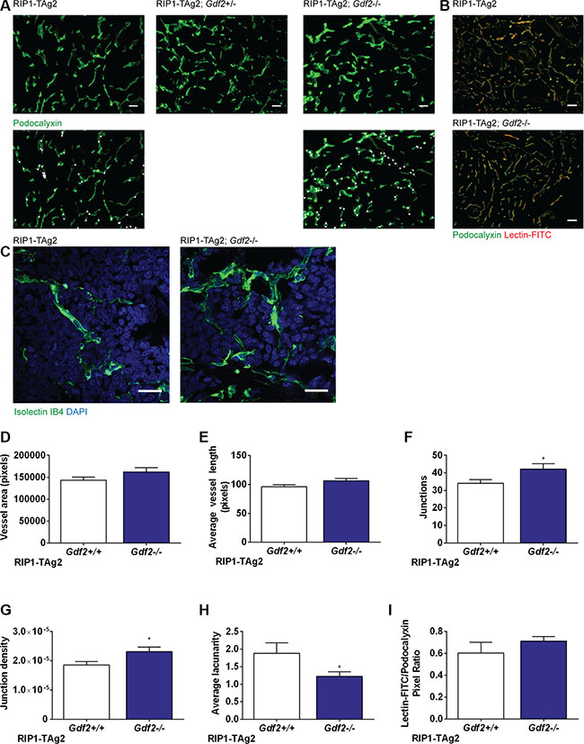 Ablation of BMP9 increases the number of vessel junctions and reduces lacunarity in primary tumor vasculature.