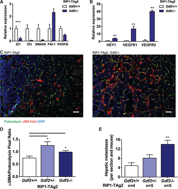 Ablation of BMP9 increases hepatic metastases and affects downstream ALK1 and Notch signaling.