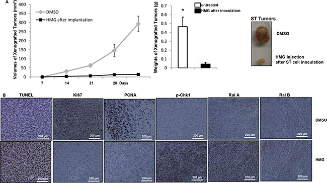 Induction of apoptosis in the xenografted ST tumors or soft tissue tumors isolated from Nf1-deficient mice upon HMG injection.