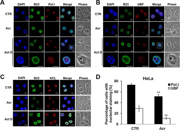 Acrolein decreases nucleolar RNA polymerase I (Pol I) and UBF translocation and induces nucleolar disintegration.