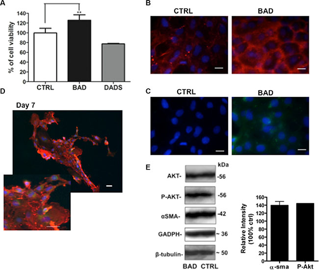 Effects of BAD-NE on cell viability of Lin&#x2013; Sca-1+ hCPC line.