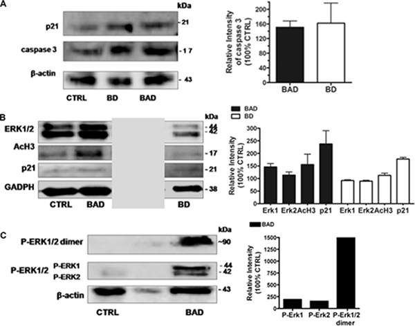 Western blotting analysis of MCF 7 cell line after 24 h of treatment with BAD-NE.