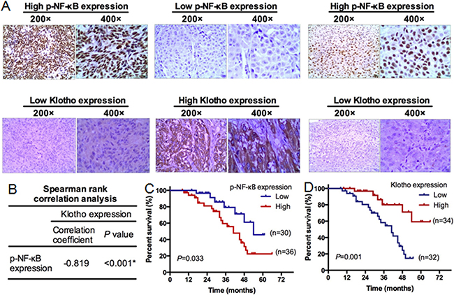 Klotho expression in human melanoma tissues and its clinical significance.