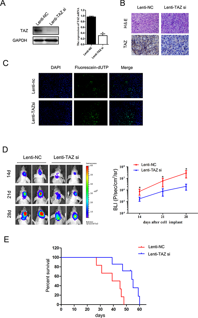 The effect of TAZ on glioma growth in vivo.