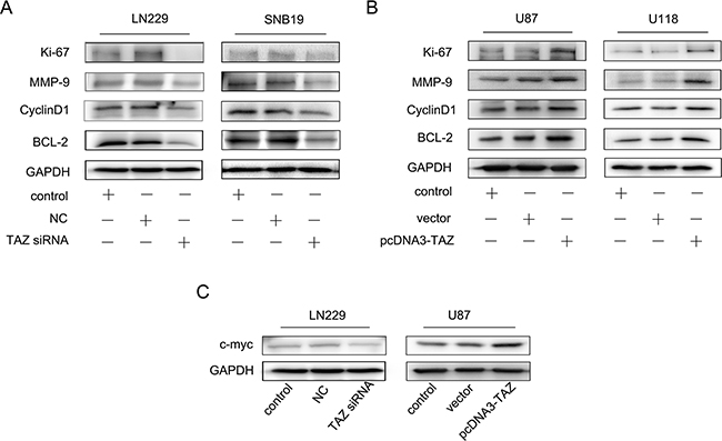 Effect of TAZ on expression of Ki67, MMP-9, Cyclin D1, Bcl-2 in vitro.