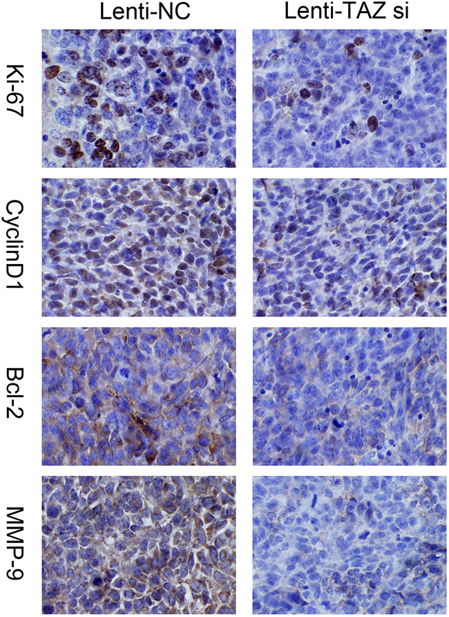 Expression of Ki67, MMP-9, Cyclin D1, Bcl-2 was suppressed in xenograft samples with TAZ knocked down examined by immunohistochemiscal staining (&#x00D7;200).