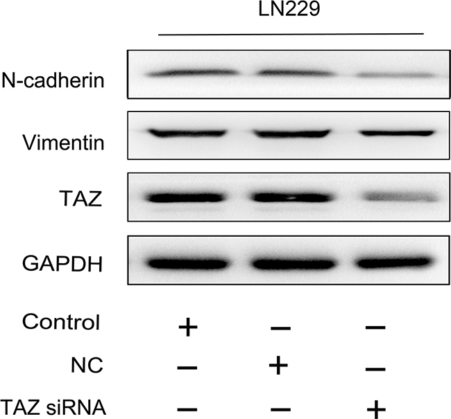 Vimentin and N-cadherin were suppressed when TAZ was knocked down in glioma cell.