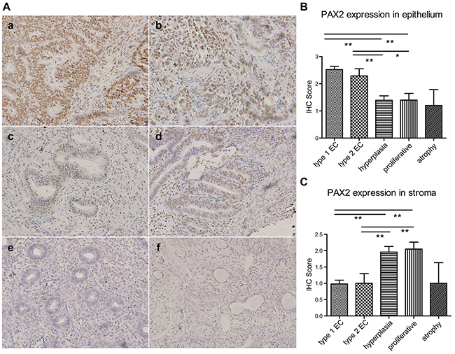 PAX2 expression in endometrial tissues.