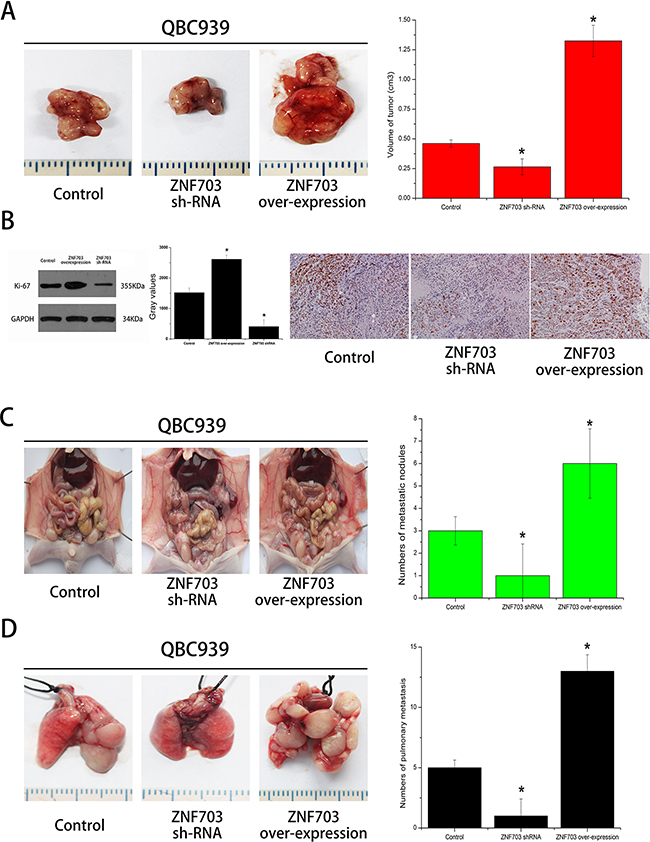 ZNF703 promotes CCA tumor growth and metastasis in vivo.