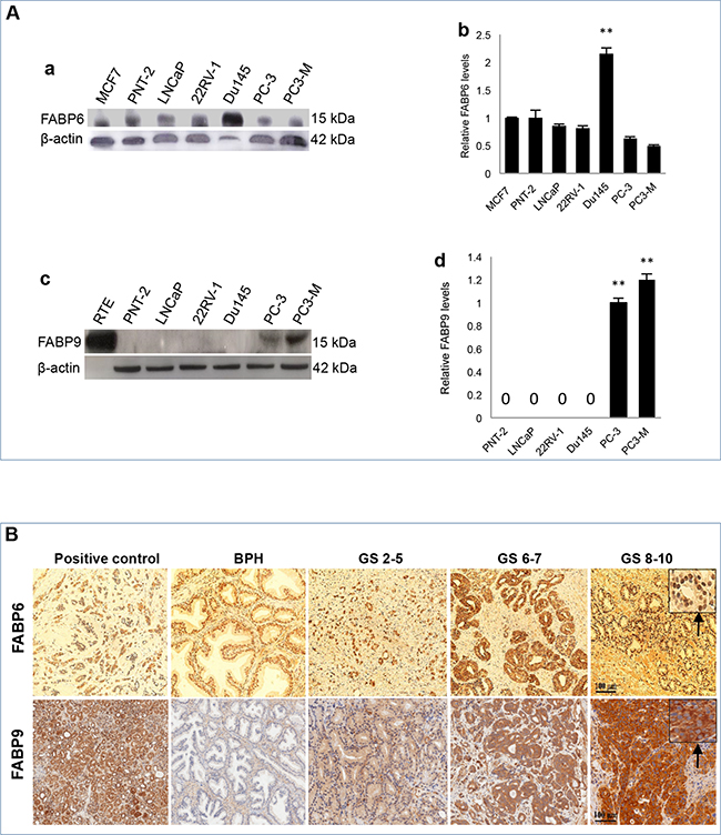 Expression of FABP6 and FABP9 in prostate cell lines and tissues.