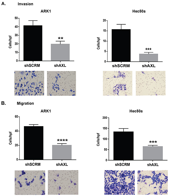 AXL is essential to invasion and migration of endometrial cancer cells.