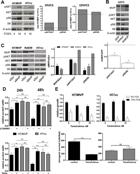 MVP supports migration and starvation resistance of GBM cells mainly via PI3K pathway upregulation.